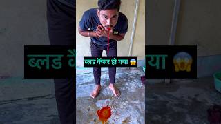 ब्लड कैंसर हो गया 😭minivlog kese vairal kare minivlog kese bnaye minivlog kese bnaye mobile se [upl. by Rehteh]