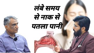 नाक से पतला पानी ।। Allergic rhinitis [upl. by Charo]