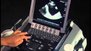 How To Ultrasound FAST Exam  Male Pelvis [upl. by Laurel239]