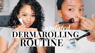 REMOVE ACNE SCARS COMPLETELY UPDATED MICRONEEDLING AT HOME ROUTINE  Pamela Ross [upl. by Alakim]