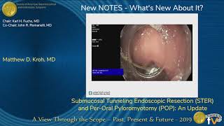 Submucosal Tunneling Endoscopic Resection STER and PerOral Pyloromyotomy POP An Update [upl. by Sueahccaz]