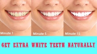 How to get White Teeth in 2 minutes  Natural Home Remedy [upl. by Eaned278]