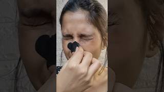 Part2 blackhead remove nose strip 😱🤯❌️nosestrip blackheadremovalnewthisweek beauty makeuptips [upl. by Atteroc]