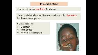 24 Nematodes revision  Dr Noha Madbouly [upl. by Pavlov]