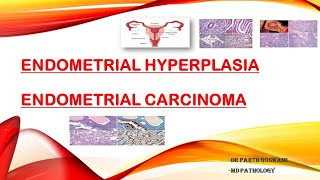 Endometrial Carcinoma amp Endometrial Hyperplasia [upl. by Bullivant]