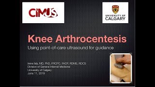 US Guided Knee Arthrocentesis [upl. by Adohr]