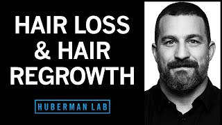 5 Tips to Grow Hair MUCH FASTER amp THICKER  Alex Costa [upl. by Samid]