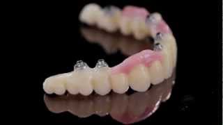 K Dental LabZirkonzahn PrettauImplant screwretained bridge1mov [upl. by Ainwat]