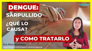 🟢 RASH y PICAZÓN en el DENGUE POR QUÉ OCURRE y CÓMO HACER que DESAPAREZCA 🦟 [upl. by Inilahs]