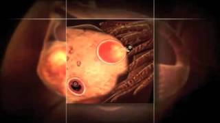 In Vitro Fertilization IVF documentary part 1 [upl. by Notak]