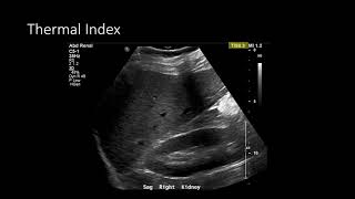 Ultrasound Physics  Image Optimization [upl. by Verena]