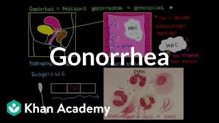 Pathophysiology diagnosis treatment and prevention of gonorrhea  NCLEXRN  Khan Academy [upl. by Ynehpets567]