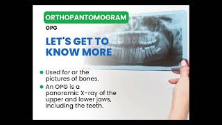 orthopantomogram OPG is a common radiograph used to identify the hard tissues of the oral cavity [upl. by Essenaj]