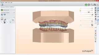 Digital SCI Dual Arch Sliders Design Overview [upl. by Euqor]