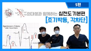 의대생과 함께하는 심전도 기본편 I 5 조기박동 각차단  편위전도 사보사 기준 들어봤니 [upl. by Arikal]