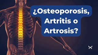 Diferenciando Osteoporosis Artritis y Artrosis Lo Que Debes Saber [upl. by Tome]