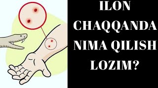 ILON CHAQQANDA NIMA QILISH LOZIM [upl. by Ebner423]