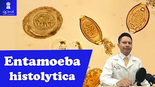 Conoce a Entamoeba histolytica morfología y CLAVES para su identificación🔬 [upl. by Devitt101]