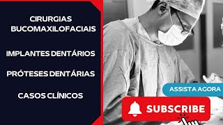 Transformações Faciais Os Poderosos Procedimentos da Cirurgia Bucomaxilofacial CTBMF [upl. by Nayab]