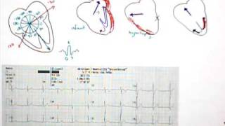 12 Lead EKG Part 5 QRS Axis [upl. by Nirol954]