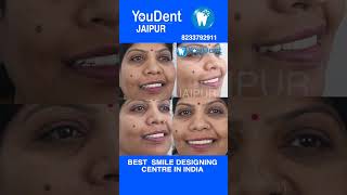 smile makeover bestcentreforsmilemakeover bestcentreforsmiledesigning bestdentistinjaipur smile [upl. by Agathy]