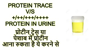 protein trace in urine vs protein  प्रोटीन ट्रेस या पेशाब में प्रोटीन आना रुकता है ये करने से [upl. by Lorette]