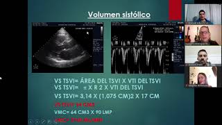 Elementi di ecocardiografia VII video valvulopatia aortica [upl. by Fagaly]