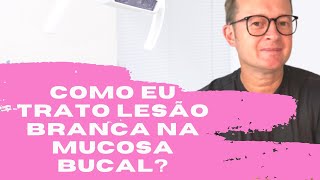 Como eu trato lesão branca na mucosa bucal  Prof Mauricio Volkweis [upl. by Arhas]