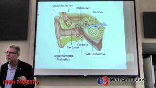 Auditory Evoked Potentials  OtoAcoustic Emissions OAE [upl. by Donadee]