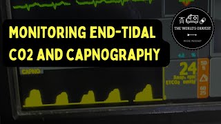 End Tidal CO2 and Capnography [upl. by Kunin356]