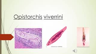 Clonorchis sinensis y opistorchis viverrini [upl. by Nnylak]