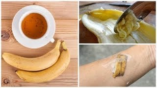 5 Verwendungsmöglichkeiten von Bananenschalen als Naturheilmittel [upl. by Ayanet]