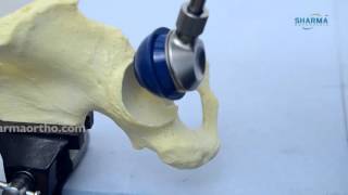 Total Hip Replacement System Cemented  Hip Replacement [upl. by Farrand]