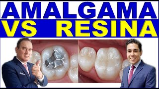 ✅ AMALGAMA DENTAL VS RESINAS DENTALES VENTAJAS Y DESVENTAJAS [upl. by Ethan]