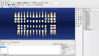 Hard Tissue Charting on Dentrix [upl. by Repohtsirhc431]