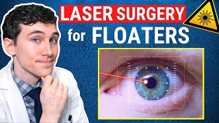 Laser Surgery for Eye Floaters Treatment Laser Vitreolysis [upl. by Alburg]