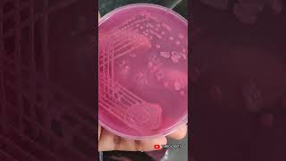 Macconkey agar  culture media  tjbiologist  biology  science  media streaking  medical [upl. by Alyaj235]