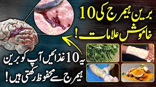 What Happens In Brain Hemorrhage  Symptoms Causes And Treatment Urdu Hindi [upl. by Rollet]