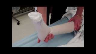 CNA Essential Skills  Apply One KneeHigh Elastic Stocking 413 [upl. by Hutner209]