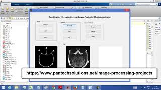 Curvelet and Wavelet Based Image Fusion [upl. by Jean-Claude]