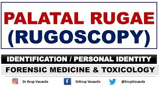 Rugoscopy  Palatal Rugae  Identification  Dr Krup Vasavda [upl. by Aisinut]