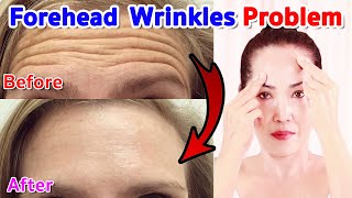 Forehead wrinkles problem  NO TALKING  Facial Massage [upl. by Alodie]