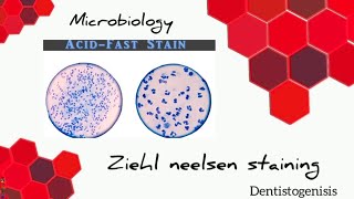 Ziehl Neelsen staining  Acid Fast staining microbiology 2ndyear BDS [upl. by Ennaul]