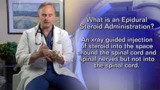 Epidural Steroid InjectionPatient Education Video [upl. by Einahc98]