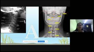 Importancia de la Radiología en Quiropráctica  ELAESI [upl. by Erwin]