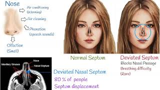 Deviated septum symptoms treatments and causes Nasal Septal deviation [upl. by Inej694]