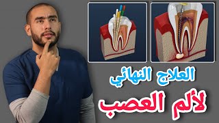 علاج الم الاسنان وحشو العصب  التهاب العصب الأسباب والعلاج  علاج الم العصب [upl. by Wojak72]