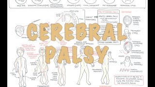 Cerebral Palsy  DETAILED Overview [upl. by Hennie]