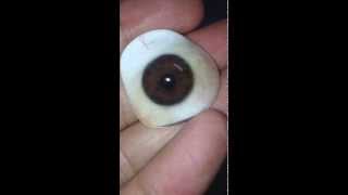 Life Like Custom Made Artificial Eye Kuldeep Raizada BCO [upl. by Ytineres]