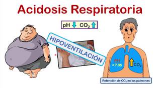 INTERPRETACIÓN DE LA GASOMETRÍA EN 4 PASOS 💉💉 con EJERCICIOS de PRÁCTICA al final del video [upl. by Rhyner709]